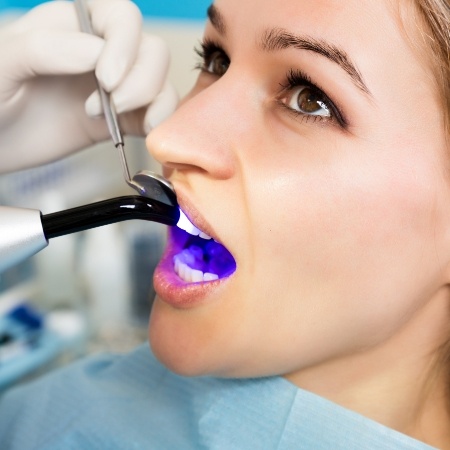 Dental patient receiving cosmetic dental bonding