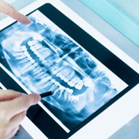 Emergency dentist reviewing patient's X-ray