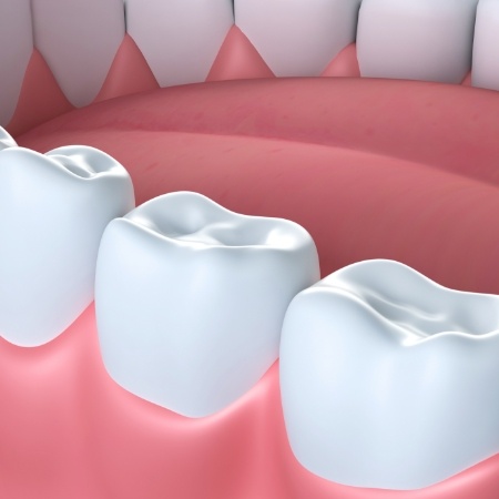 Animated smile with dental sealants